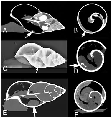 Case report: Four cases of kidney disease in Giant African Land Snails (Lissachatina fulica)